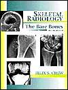   Bare Bones, (0683016806), Felix S. Chew, Textbooks   