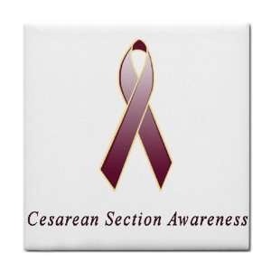 Cesarean Section Awareness Ribbon Tile Trivet