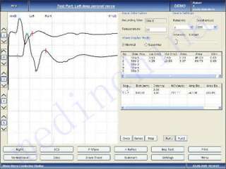 PC based 4 Channel EMG/EP Measuring System Neurology GM  