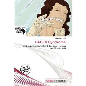  FACES Syndrome (9786200839169) Iosias Jody Books