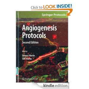 Tumour Angiogenesis and chemotherapy Anser Ali  Kindle 