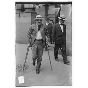  Alexander Berkman on crutches